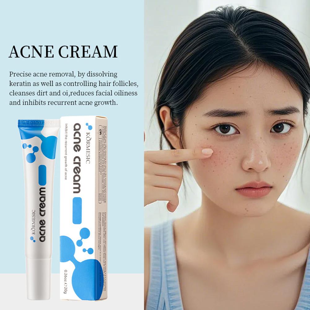 20% Azelaic Acid Acne Removing - Luxury Skincare Brands review and price